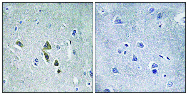 Anti-OAZ1 antibody produced in rabbit affinity isolated antibody