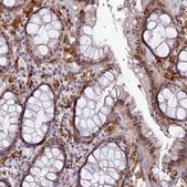 Anti-ABHD17A antibody produced in rabbit Prestige Antibodies® Powered by Atlas Antibodies, affinity isolated antibody, buffered aqueous glycerol solution