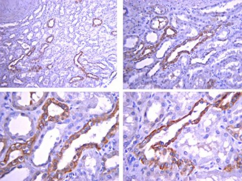 Anti-GLUT-8 Antibody, CT from rabbit