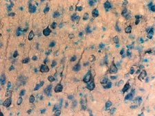 Anti-P2X4 Receptor Antibody Chemicon®, from rabbit