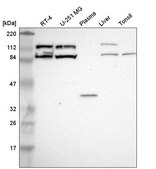 Anti-CLCN5 antibody produced in rabbit Prestige Antibodies® Powered by Atlas Antibodies, affinity isolated antibody
