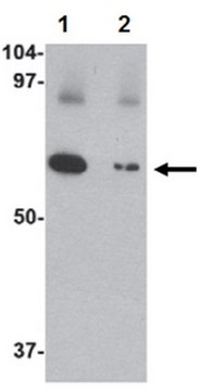 Anti-Slc22A17 Antibody from rabbit, purified by affinity chromatography