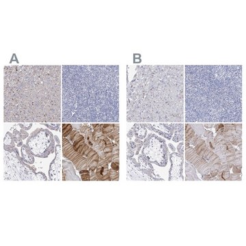 Anti-NRAP antibody produced in rabbit Prestige Antibodies&#174; Powered by Atlas Antibodies, affinity isolated antibody, buffered aqueous glycerol solution