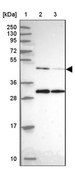 Anti-ACTR3 antibody produced in rabbit Prestige Antibodies&#174; Powered by Atlas Antibodies, affinity isolated antibody, buffered aqueous glycerol solution
