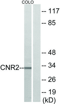 Anti-CNR2 antibody produced in rabbit affinity isolated antibody