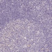 Anti-PPFIA4 antibody produced in rabbit Prestige Antibodies® Powered by Atlas Antibodies, affinity isolated antibody, buffered aqueous glycerol solution