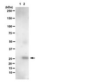 Anti-phospho-Bcl-2 (Ser70) Antibody, clone 69-10C-2-10C-18, rabbit monoclonal clone 69-10C-2-10C-18, from rabbit, unconjugated