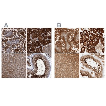 Anti-PCYT2 antibody produced in rabbit Prestige Antibodies&#174; Powered by Atlas Antibodies, affinity isolated antibody, buffered aqueous glycerol solution, Ab1