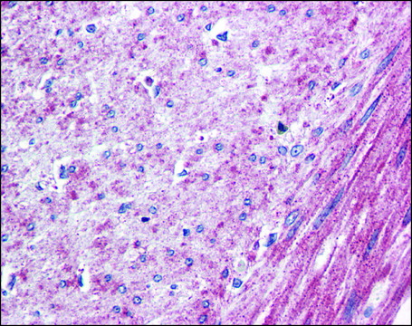 Anti-ELTD1 antibody produced in rabbit affinity isolated antibody