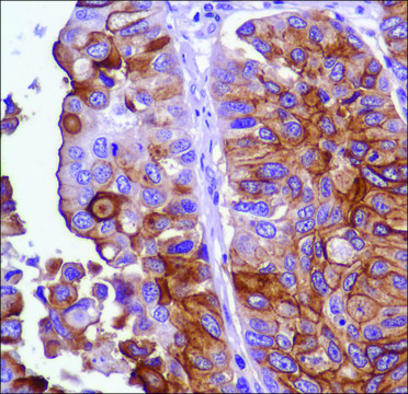 Anti-Uroplakin III antibody, Rabbit monoclonal recombinant, expressed in proprietary host, clone SP73, affinity isolated antibody