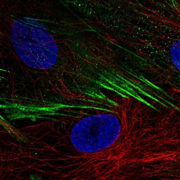 Anti-SCN9A antibody produced in rabbit Prestige Antibodies&#174; Powered by Atlas Antibodies, affinity isolated antibody