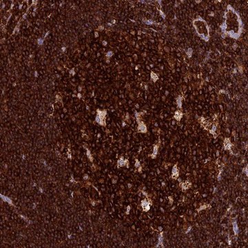 Anti-ADAT1 antibody produced in rabbit Prestige Antibodies&#174; Powered by Atlas Antibodies, affinity isolated antibody, buffered aqueous glycerol solution