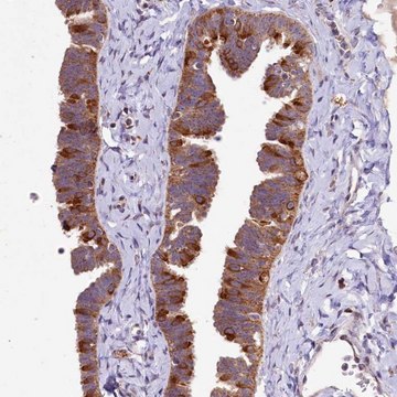 Anti-DYNC2H1 antibody produced in rabbit Prestige Antibodies&#174; Powered by Atlas Antibodies, affinity isolated antibody, buffered aqueous glycerol solution