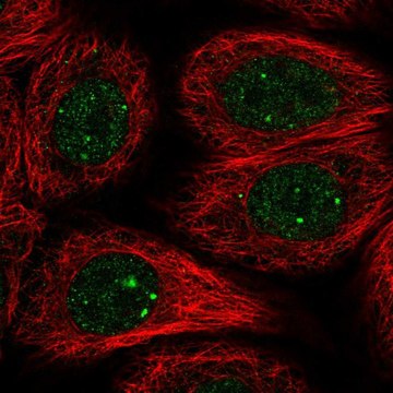 Anti-RAD51B antibody produced in rabbit Prestige Antibodies&#174; Powered by Atlas Antibodies, affinity isolated antibody