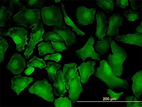 Monoclonal Anti-PTK7 antibody produced in mouse clone 4F5, purified immunoglobulin, buffered aqueous solution