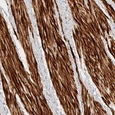 Anti-TTI2 antibody produced in rabbit Prestige Antibodies® Powered by Atlas Antibodies, affinity isolated antibody, buffered aqueous glycerol solution
