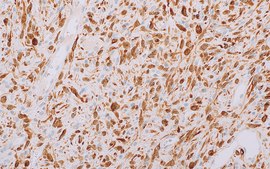 MDM2 (IF2) Mouse Monoclonal Antibody