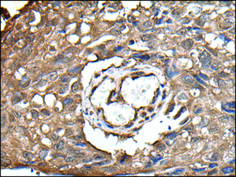 Anti-UBE2D3 affinity isolated antibody