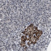 Anti-USP16 antibody produced in rabbit Prestige Antibodies® Powered by Atlas Antibodies, affinity isolated antibody, buffered aqueous glycerol solution