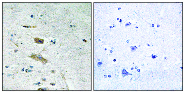 Anti-ABHD4 antibody produced in rabbit affinity isolated antibody