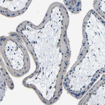 Anti-THSD1 antibody produced in rabbit Prestige Antibodies&#174; Powered by Atlas Antibodies, affinity isolated antibody, buffered aqueous glycerol solution