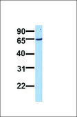 Anti-ACADVL antibody produced in rabbit affinity isolated antibody