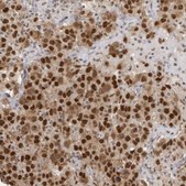 Anti-RPA2 antibody produced in rabbit Prestige Antibodies® Powered by Atlas Antibodies, affinity isolated antibody, buffered aqueous glycerol solution, ab1