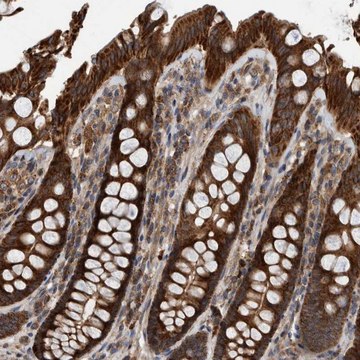 Anti-ABCA5 antibody produced in rabbit Prestige Antibodies&#174; Powered by Atlas Antibodies, affinity isolated antibody, buffered aqueous glycerol solution