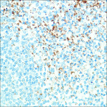 Anti-CD42B antibody, Rabbit monoclonal clone SP202, recombinant, expressed in proprietary host, affinity isolated antibody