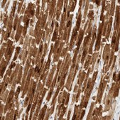 Anti-PLN antibody produced in rabbit Prestige Antibodies&#174; Powered by Atlas Antibodies, affinity isolated antibody, buffered aqueous glycerol solution