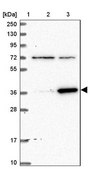 Anti-ZNF609 antibody produced in rabbit Prestige Antibodies® Powered by Atlas Antibodies, affinity isolated antibody, buffered aqueous glycerol solution