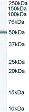 Anti-DGAT1 antibody produced in goat affinity isolated antibody, buffered aqueous solution