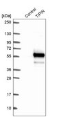 Anti-TIPIN antibody produced in rabbit Prestige Antibodies® Powered by Atlas Antibodies, affinity isolated antibody, buffered aqueous glycerol solution