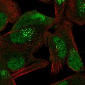 Anti-CAND1 antibody produced in rabbit Prestige Antibodies® Powered by Atlas Antibodies, affinity isolated antibody