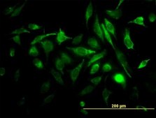 Monoclonal Anti-RAB3B antibody produced in mouse clone 3F12, purified immunoglobulin, buffered aqueous solution