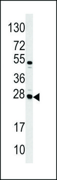 ANTI-CASA (CENTER) antibody produced in rabbit purified immunoglobulin, buffered aqueous solution