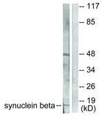 Anti-Synuclein β antibody produced in rabbit affinity isolated antibody