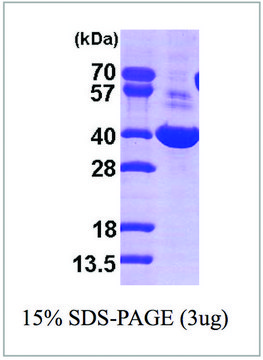 AKR1C1 human recombinant, expressed in E. coli, &#8805;90% (SDS-PAGE)