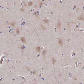 Anti-PTHLH antibody produced in rabbit Prestige Antibodies® Powered by Atlas Antibodies, affinity isolated antibody, buffered aqueous glycerol solution