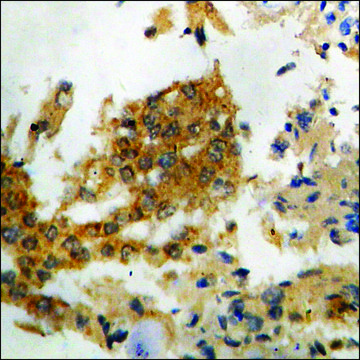 Anti-phospho-PKR (pThr258) antibody produced in rabbit affinity isolated antibody