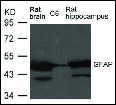 Anti-GFAP antibody produced in rabbit affinity isolated antibody