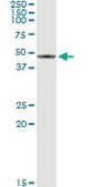 Monoclonal Anti-SERPINB2 antibody produced in mouse clone 3A9, purified immunoglobulin, buffered aqueous solution
