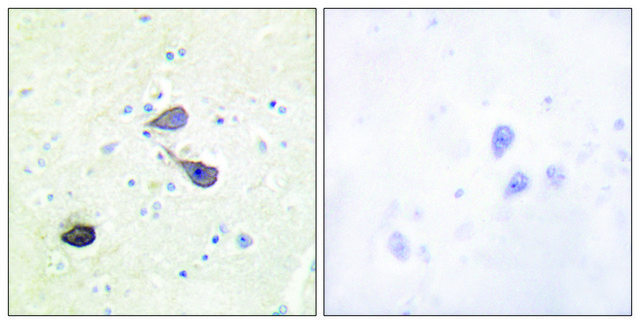 Anti-KOR-1 antibody produced in rabbit affinity isolated antibody