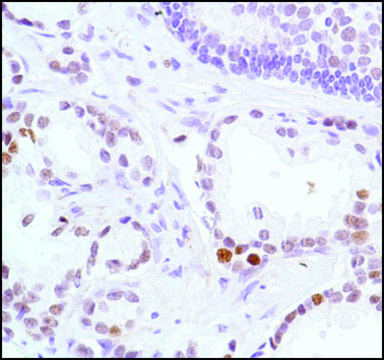 Anti-EZH2 antibody, Rabbit monoclonal recombinant, expressed in proprietary host, clone SP129, affinity isolated antibody