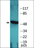 Anti-phospho-hnRNP K (pSer284) antibody produced in rabbit affinity isolated antibody