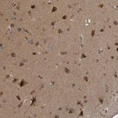 Anti-RAB3GAP2 antibody produced in rabbit Prestige Antibodies® Powered by Atlas Antibodies, affinity isolated antibody, buffered aqueous glycerol solution, Ab2