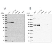 Anti-PUF60 antibody produced in rabbit Prestige Antibodies® Powered by Atlas Antibodies, affinity isolated antibody, buffered aqueous glycerol solution