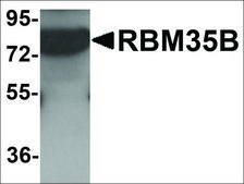 Anti-ESRP2 antibody produced in rabbit affinity isolated antibody