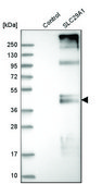 Anti-SLC29A1 antibody produced in rabbit Prestige Antibodies® Powered by Atlas Antibodies, affinity isolated antibody, buffered aqueous glycerol solution