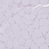 抗-GORASP1 兔抗 Prestige Antibodies® Powered by Atlas Antibodies, affinity isolated antibody, buffered aqueous glycerol solution